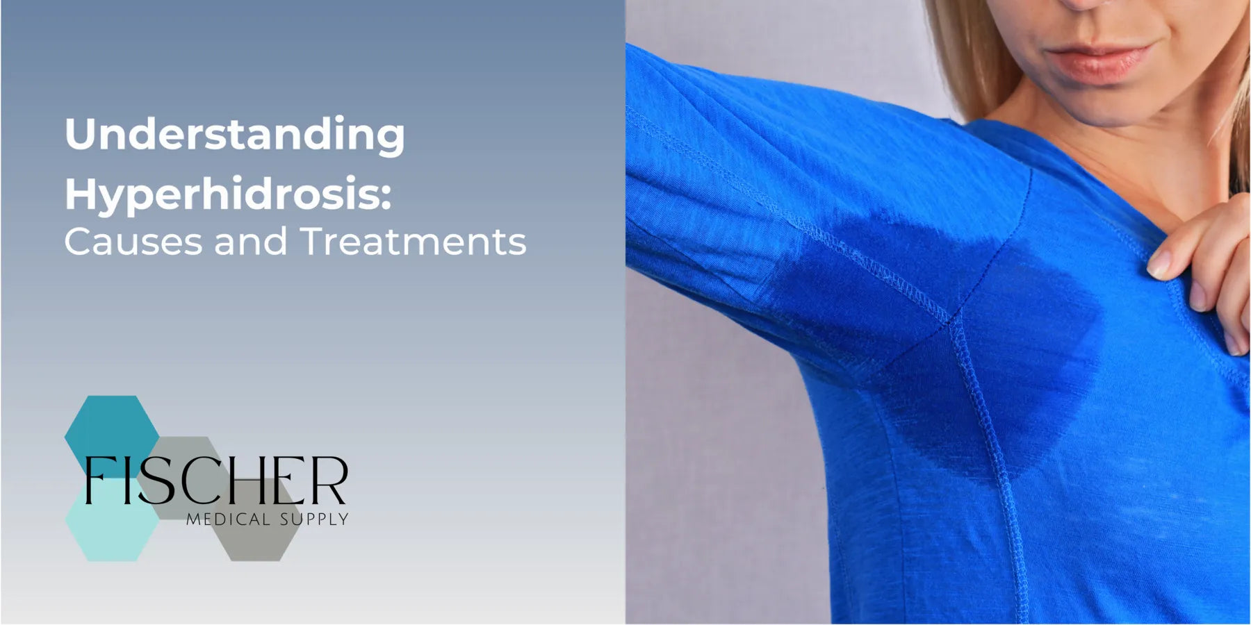 Understanding Hyperhidrosis: Causes and Treatments